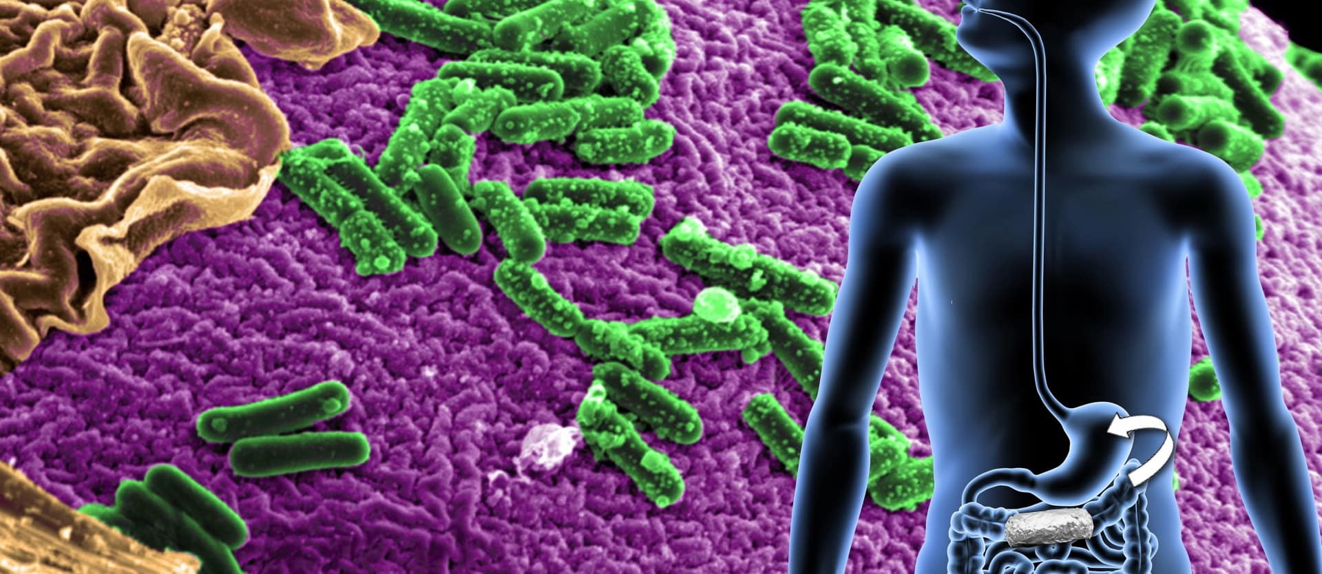 image of gut bacteria