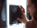 Consequences of False-Positive Mammogram Results